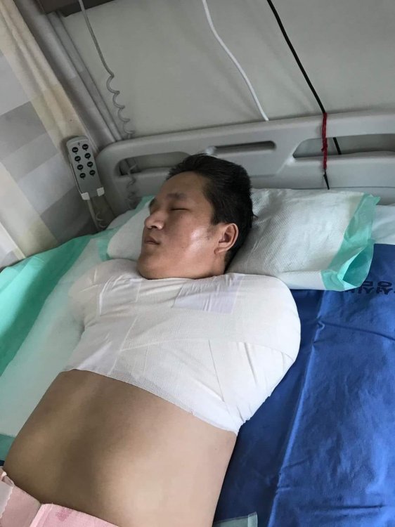 БНСУ-Д ЦАХИЛГААНД ЦОХИУЛСАН ЗАЛУУГИЙН ЭГЧ: Амьдралын төлөө тэмцэж явсан дүү минь хоёр гараа тайруулчихлаа